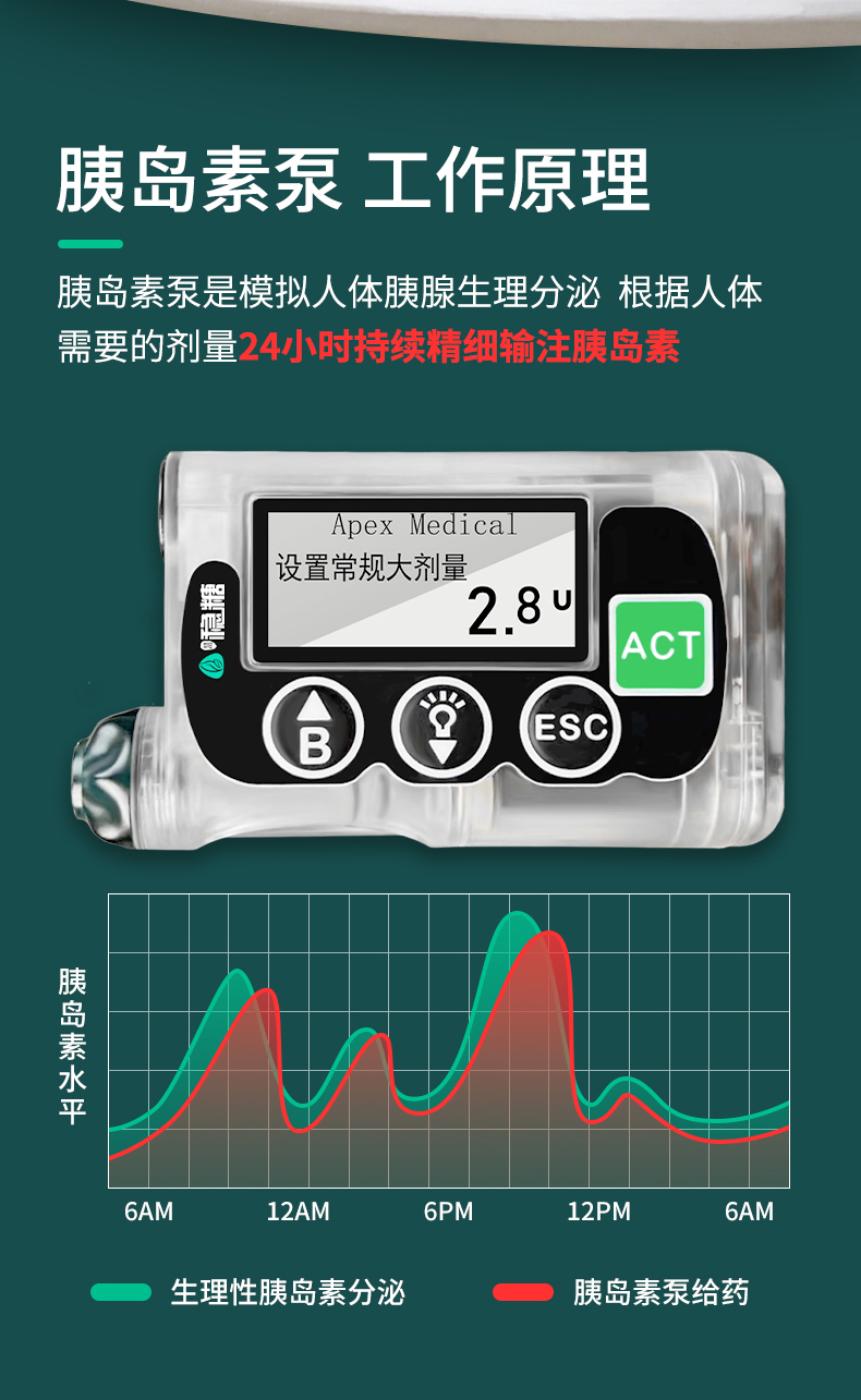 最新全自動胰島素泵，糖尿病管理的革命性進(jìn)步，全自動胰島素泵，糖尿病管理的突破性革新