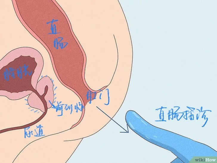 關(guān)于前列腺按摩的正確方法與部位，前列腺按摩的正確方法與部位詳解