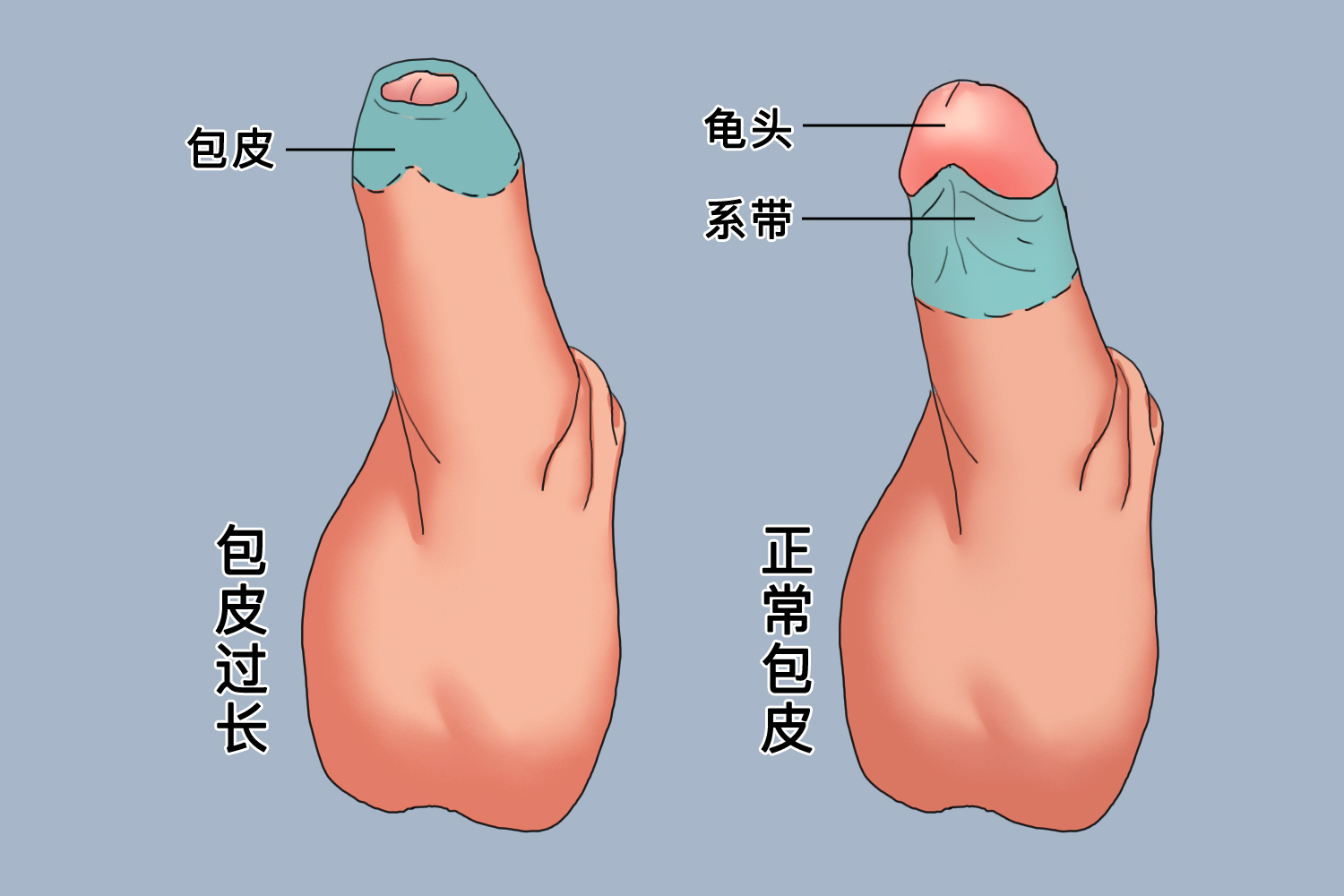 正常包皮的圖片及其相關(guān)知識(shí)科普，包皮圖片及其相關(guān)知識(shí)科普介紹