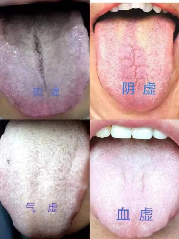 男性腎陽(yáng)虛的癥狀及其影響，男性腎陽(yáng)虛癥狀與影響概述