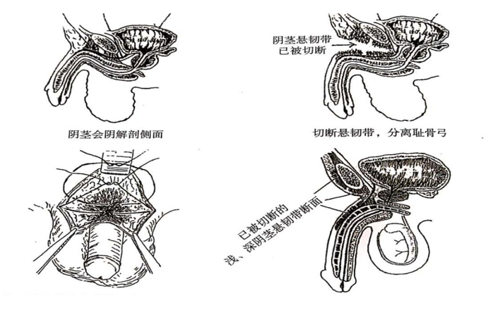 男性增大手術(shù)靠譜嗎？深度解析與探討，男性增大手術(shù)深度解析，可靠性與風(fēng)險探討